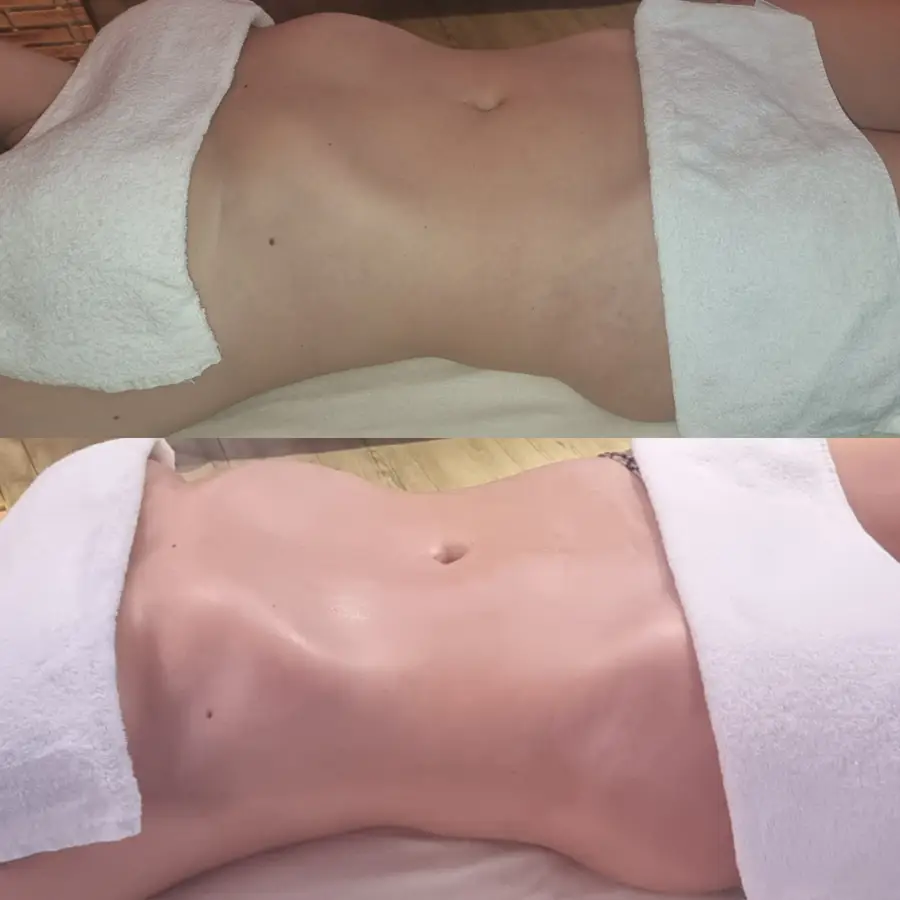 Resultado de tratamiento corporal, imagen 1 (sin identificar a la persona)
