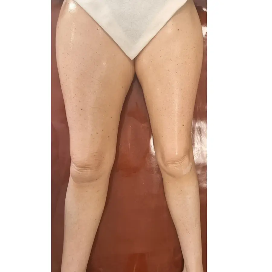 Resultado de tratamiento corporal, imagen 13 (sin identificar a la persona)