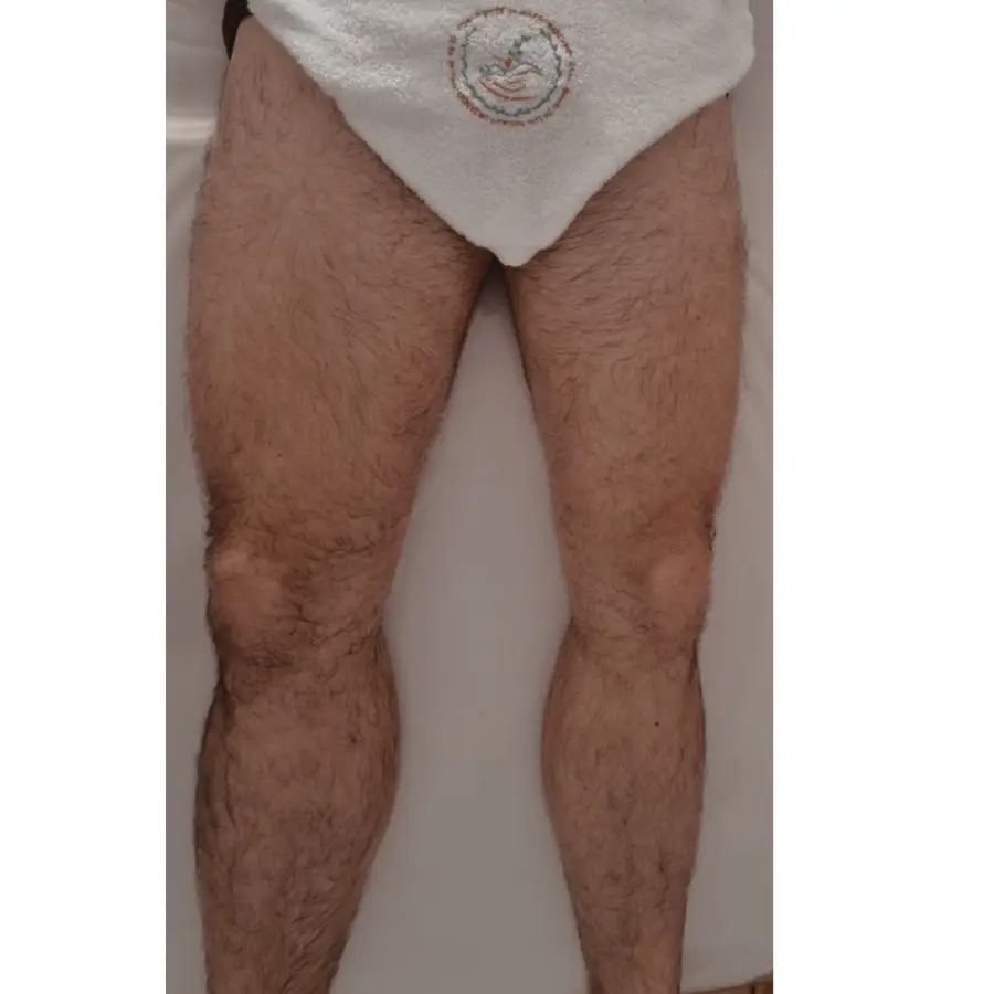 Resultado de tratamiento corporal, imagen 54 (sin identificar a la persona)