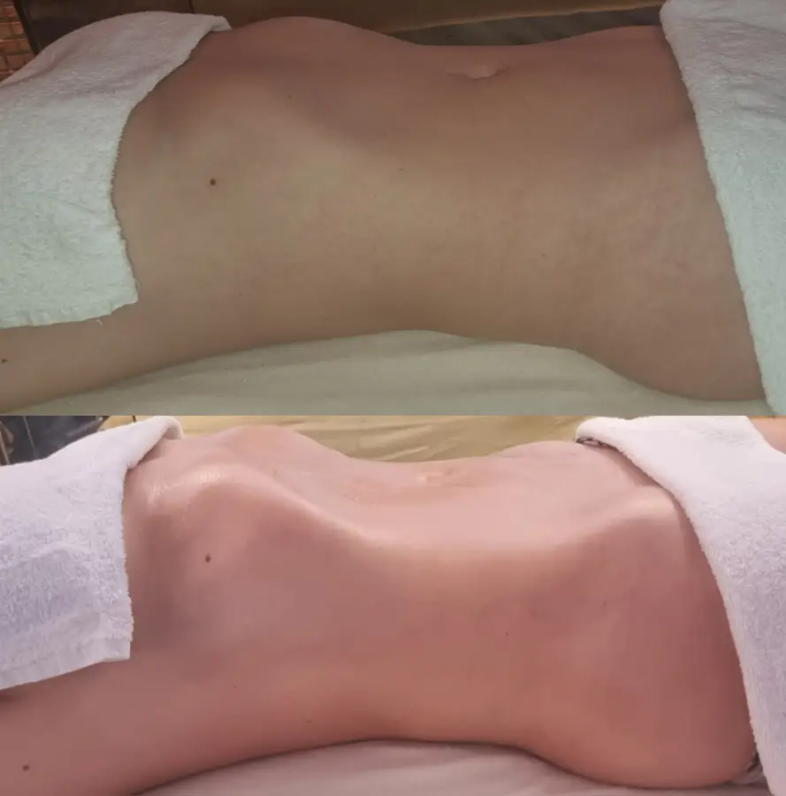Resultado de tratamiento corporal, imagen 77 (sin identificar a la persona)